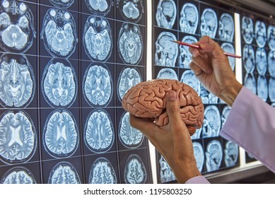 A Neurosurgeon Holding Human Brain Model And Pointing At Brain MRI On Lightbox In Medical Office