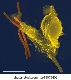 Neutrophil With An Antrax Bacteria