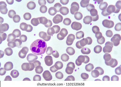 Neutrophil Cell Blood Smear Analyze By Stock Photo (Edit Now) 1120323026