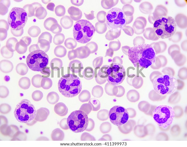 Neutrophil Cell White Blood Cell Peripheral Stock Photo (Edit Now