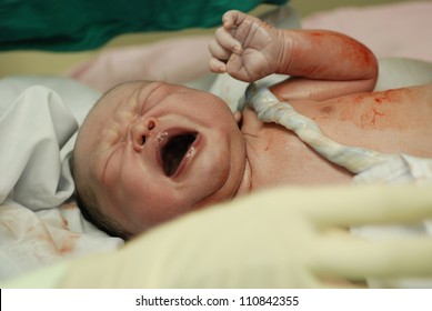 New Born Infant From Cesarean Section In Operating Theater.