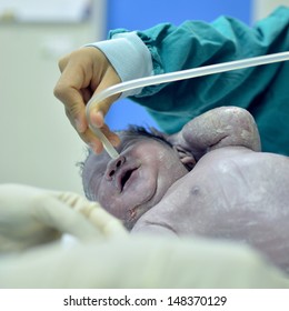 New Born Infant From Cesarean Section In Operating Theater.