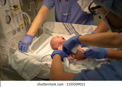A Newborn Baby Being Helped by Nurses Just after Birth