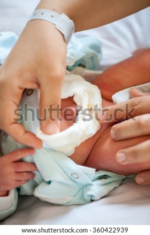 Newborn baby belly button