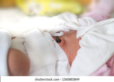 Newborn Baby Belly Cord. Baby Umbilical Cord And Dried Skin