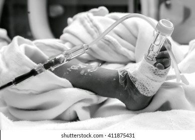 Newborn Baby With Cannula In The Feet On A Hospital Bed