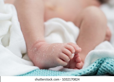 Newborn Baby Feet With Dry Skin On A White And Blue Background