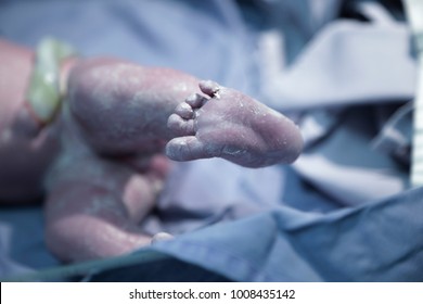 Newborn Baby Foot In A Hospital Ward