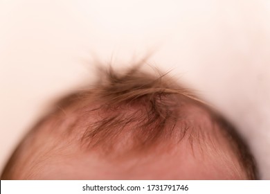 Newborn Baby Girl, Sleeping In A Light Bokeh Background. Close Up Tiny Hair In Soft Focus.