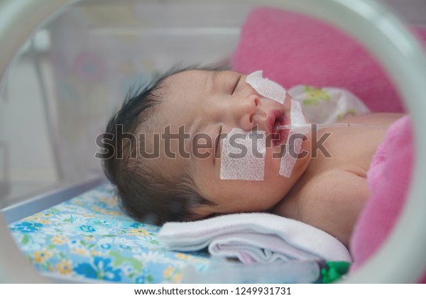 Newborn baby having\
the the breathing problem after birth. and the digestive system is\
not in normal condition. newborn in NICU,Neonatal intensive care\
unit.