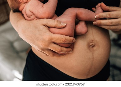 Newborn baby held by mother with postpartum belly and linea nigra