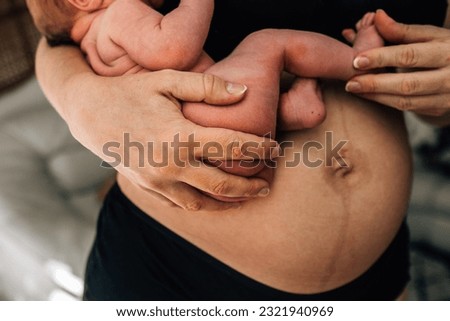 Newborn baby held by mother with postpartum belly and linea nigra