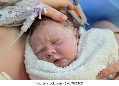 Newborn Baby At Hospital Having Skin To Skin Contact With Their Mother Straight After A Cesarean Section Birth.