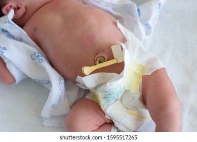  newborn baby legs in diapers