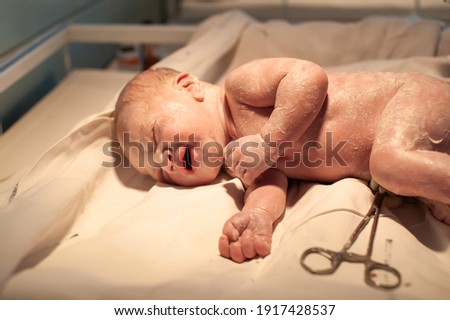 a newborn baby lies on the operating table for delivery immediately after birth.