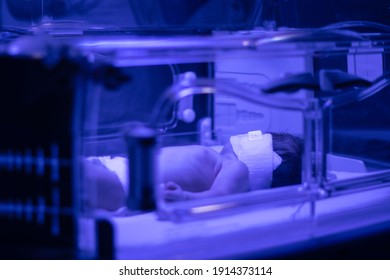 Newborn baby under ultraviolet lamp is getting treated for jaundice (elevated bilirubin) in Vancouver hospital