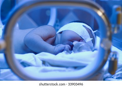 newborn baby under ultraviolet lamp in the incubator