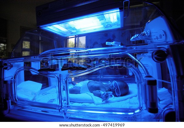 Newborn\
child baby having a treatment for jaundice under ultraviolet light\
in incubator. A neonatal intensive care unit (NICU), intensive care\
nursery (ICN) for premature newborn\
infants\
