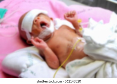 Newborn In NICU,Neonatal Intensive Care Unit.