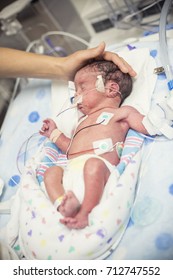 Newborn Premature Baby In The NICU Intensive Care