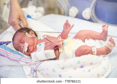 Newborn Premature Baby In The NICU Intensive Care