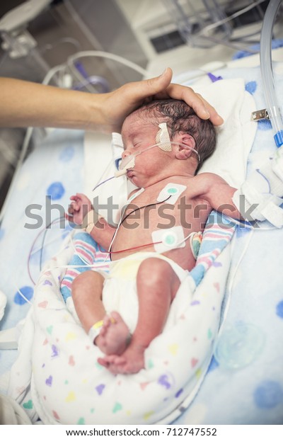 Newborn\
premature baby in the NICU intensive\
care