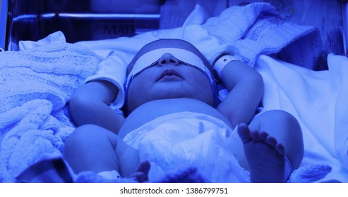 Newborn Under Jaundice Phototherapy. After Birth
