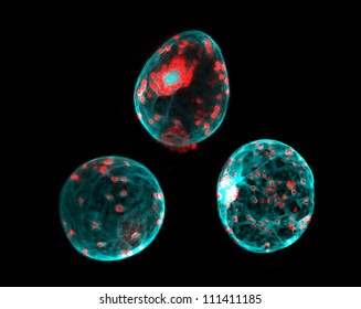 Nicotiana benthamiana leaf protoplasts expressing GFP. The cell wall was removed by treatment with enzymes (cellulase, pectinase). Confocal microscopy,