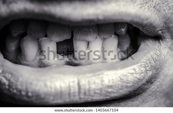 歯なし 前歯を失った人に笑顔を見せ 歯が痛い 黄色い歯 前歯のない人 歯の健康が悪く歯も無くフッ化物も無く歯の侵食も無い 白黒 の写真素材 今すぐ編集