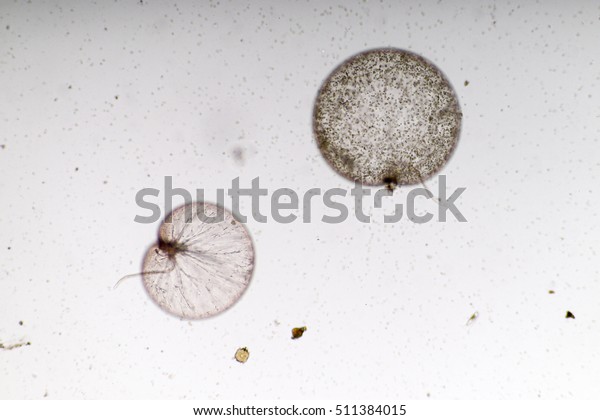 Noctiluca Dinoflagellate Marine Protozoa Under Microscope Stock Photo ...