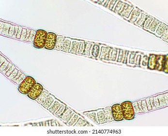 Nodularia Sp. Toxic Algae Under Microscopic View X100