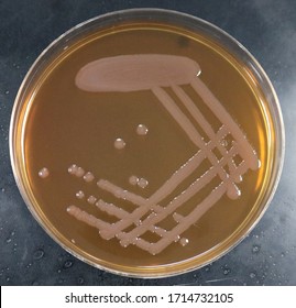 Non Lactose Fermenting Bacteria On MacConkey Agar