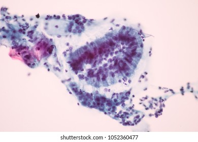 116 Endocervical Cells Images, Stock Photos & Vectors 