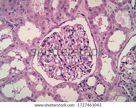 Normal kidney glomerulus surrounded by renal tubules. Some glomerular capillaries contain red blood cells. Microscopic view.