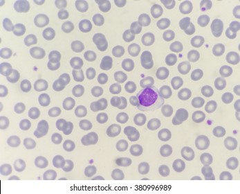 Microcytes Images, Stock Photos & Vectors | Shutterstock