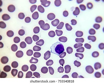 Normal Lymphocyte Blood Tester Lab Stock Photo 755540818 | Shutterstock