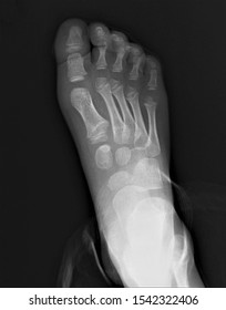 Normal Radiography Foot Medical Diagnostics Traumatology Stock Photo ...