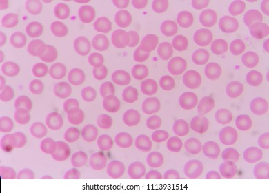 Normal Red Blood Cell On Smear