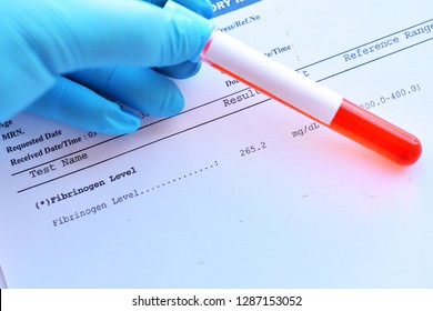 Normal Result Of Fibrinogen Testing With Blood Sample Tube