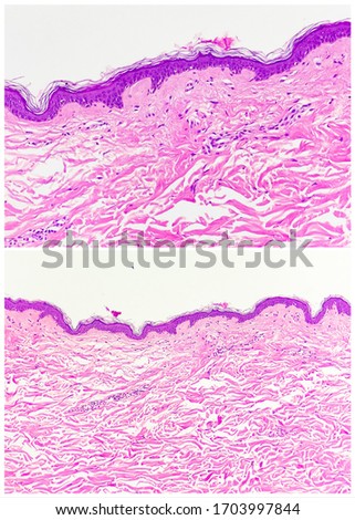 Normal skin: epidermis and dermis (magnification 200x in the upper and magnification 400x in the lower)