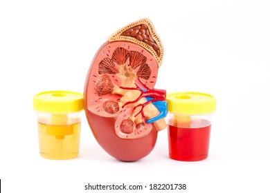 Normal Urine, Hematuria, Kidney