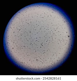 Normozoospermia semen analyzed by microscope. 