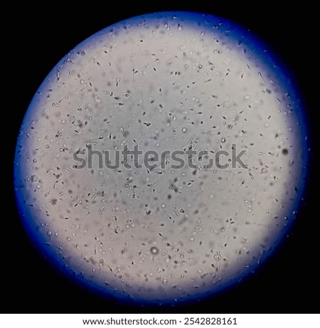 Normozoospermia semen analyzed by microscope. 