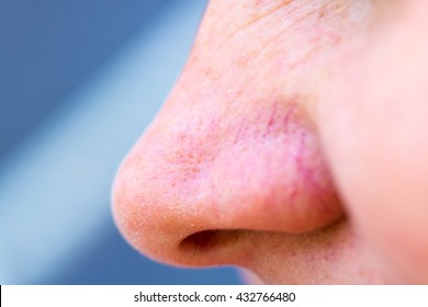 Nose Close Up