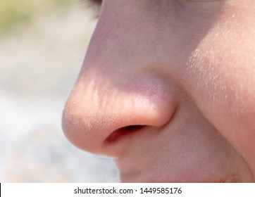 Nose Teen Boy Close Up Side View