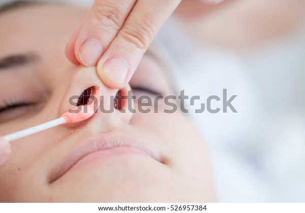 Nose Waxingnose Hair Removal Hot Wax Stock Photo Edit Now 526957384