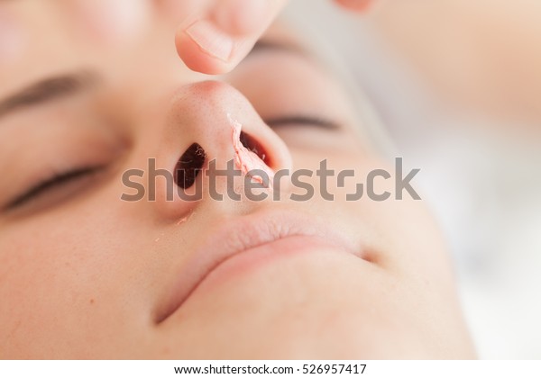 Nose Waxingnose Hair Removal Hot Wax Stock Photo Edit Now 526957417