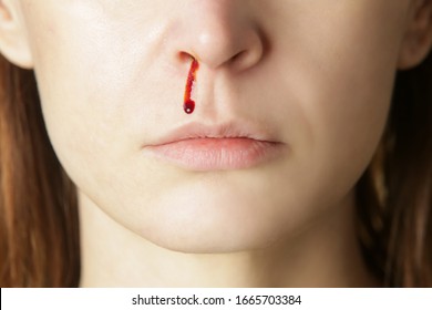 Nosebleed, a young woman with a bloody nose. Healthcare and medical concept. Close up studio image. - Shutterstock ID 1665703384