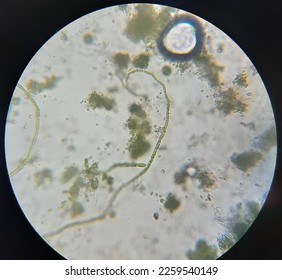 Nostoc sp under the light microscope