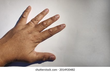 not focused. asian man right hand with calloused five fingers. white background